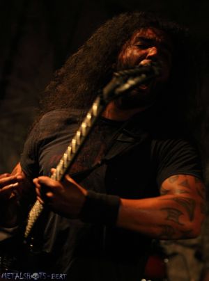 Severe Torture